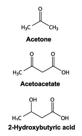 The Structure of Ketone Bodies: Acetone, Acetoacetate and 2-Hydroxybutyric Acid.