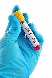 Picture of a Doctor Holding an LDL Cholesterol Test.