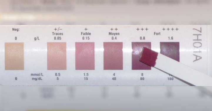 Urine Stick Colour Chart