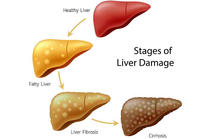 Liver Diagram / Internal Anatomy of Liver Medical Illustration Medivisuals