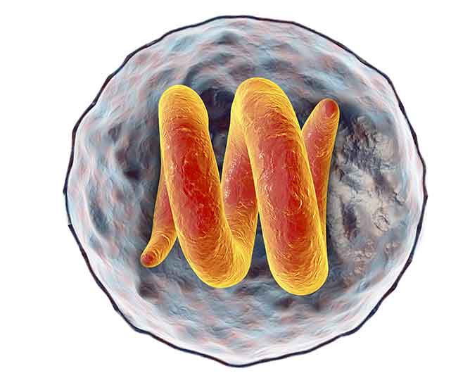 Image Showing Trichinosis Causing Roundworm Bacteria.