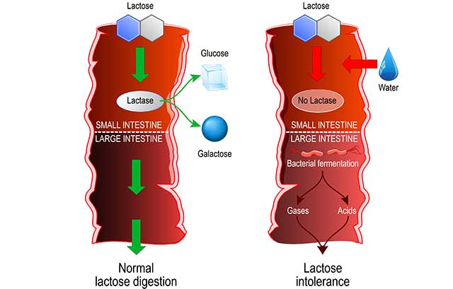 Infografische Erklärung der Laktoseintoleranz.