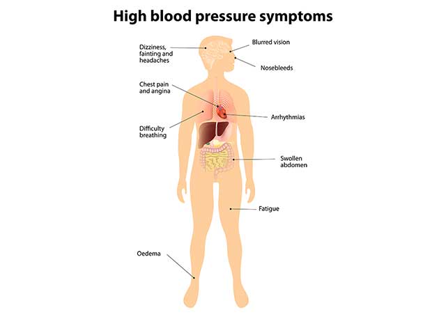 An Illustrative Diagram Showing the Symptoms of Hypertension (High Blood Pressure).