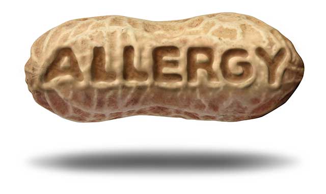 A Peanut In Its Shell With "Allergy" Written On It.