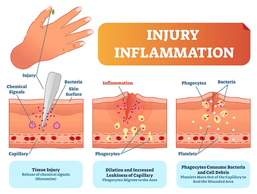 Infographic Showing the Wound Healing Process Response To Injury.