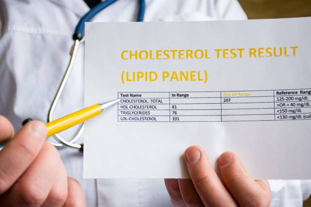 Doctor Holding Cholesterol Test (Lipid Panel) Results.